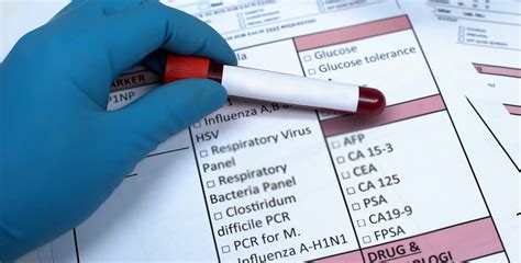 fasting blood test results results